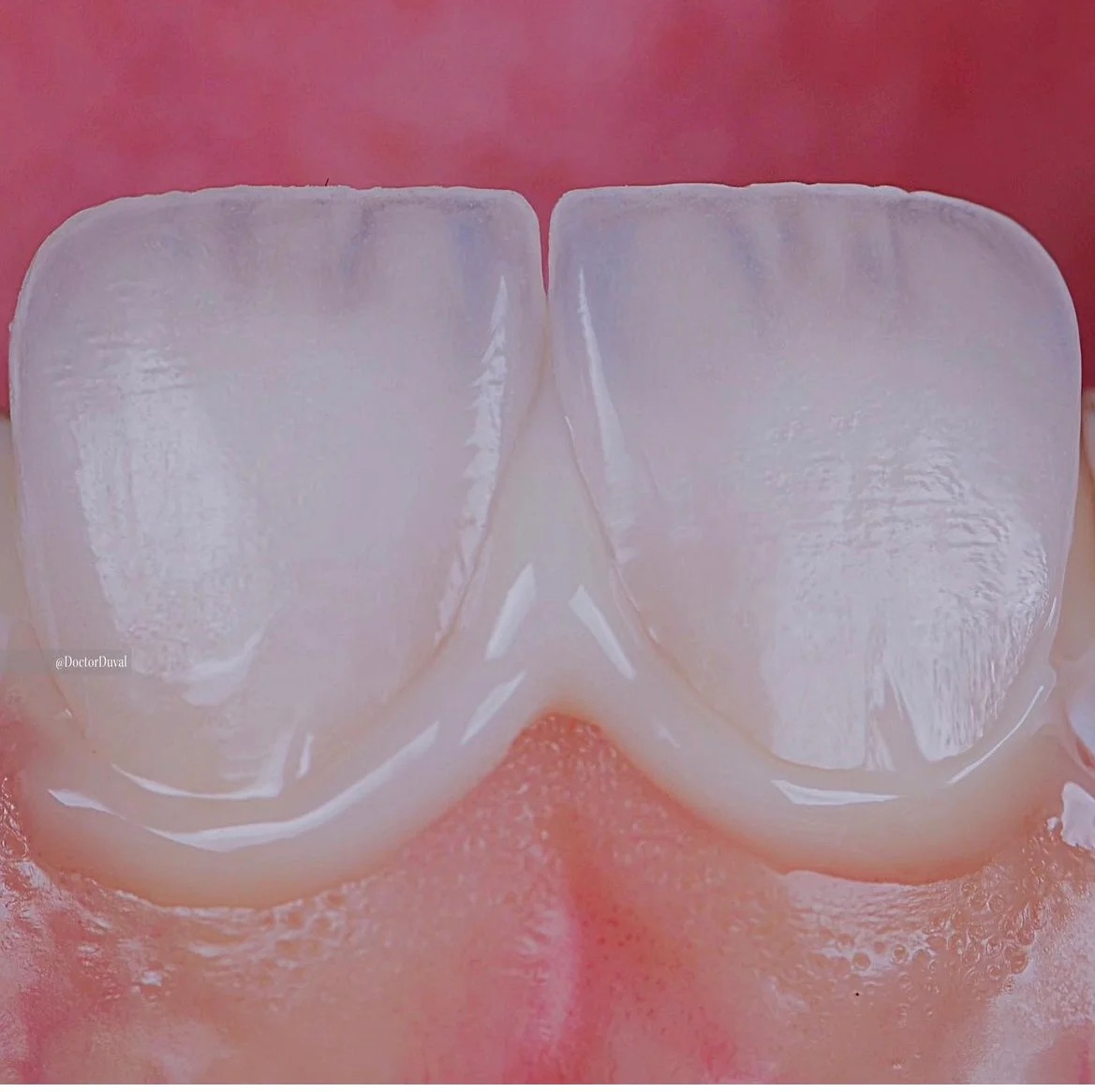 Smile transformation